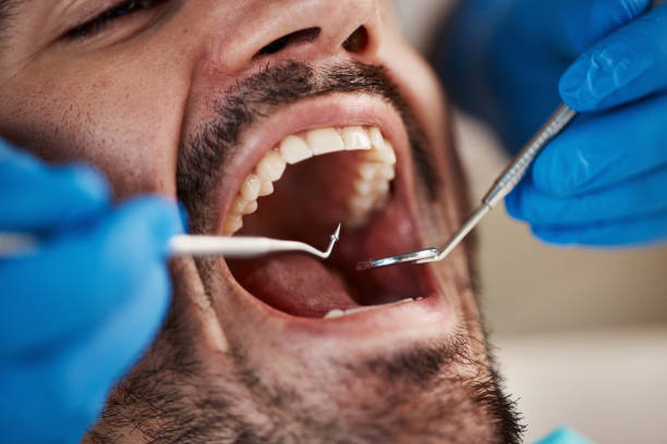 Best Teeth Whitening  in Kamas, UT